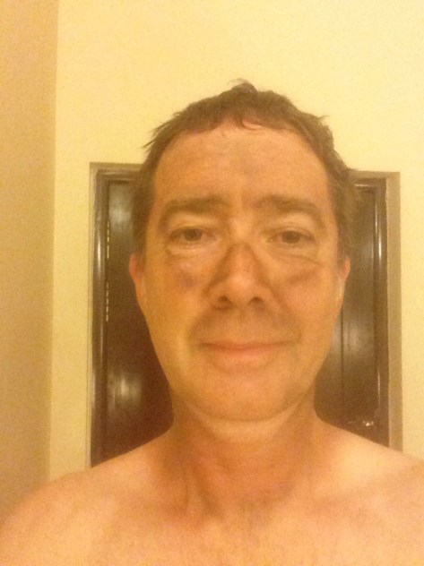 Yeh, dodgy photo but it demonstrates the pollution we consumed after a day riding through Pakistan 